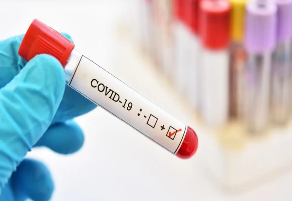 Dolj: Nouă cazuri de COVID-19, de ieri până astăzi.  Angajat ABA Jiu, între persoanele infectate