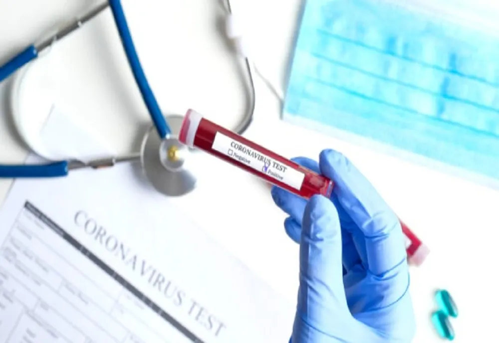 Peste 100 de cazuri noi de coronavirus, în judeţul Dolj