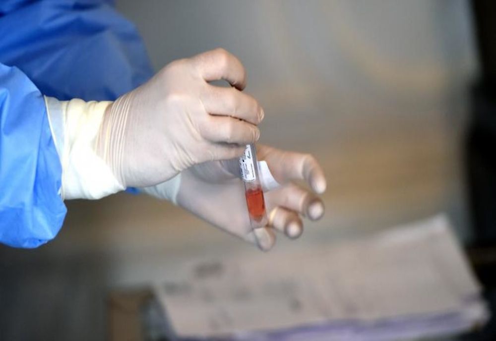 Dolj: 10 noi cazuri de coronavirus în ultimele 24 de ore 