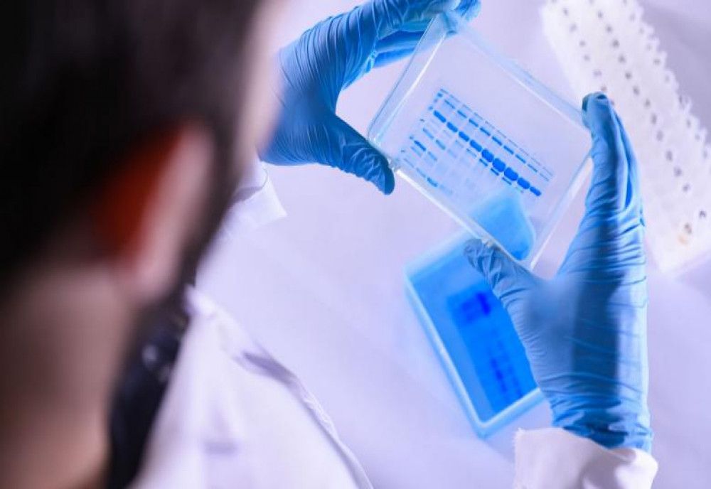 Covid-19 Dolj: 173 de îmbolnăviri, între care 113 persoane vindecate 