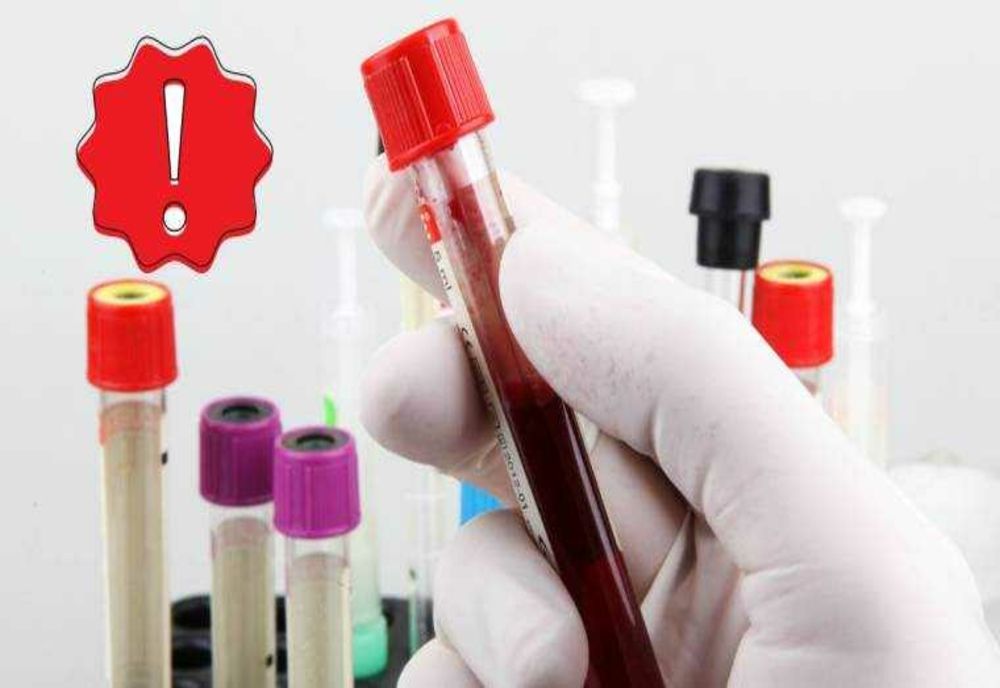 ASISTENTĂ INTERZISĂ LA DONARE, DUPĂ CE A DONAT 63 DE LITRI DE SÂNGE. MOTIVUL ESTE ABSOLUT ȘOCANT. CRTS O INVITĂ PENTRU CLARIFICAREA SITUAȚIEI