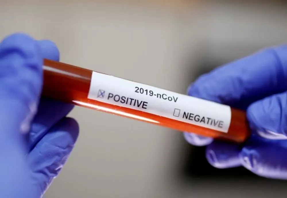 Covid-19: O femeie internată la Spitalul de Boli Infecțioase Craiova a decedat 