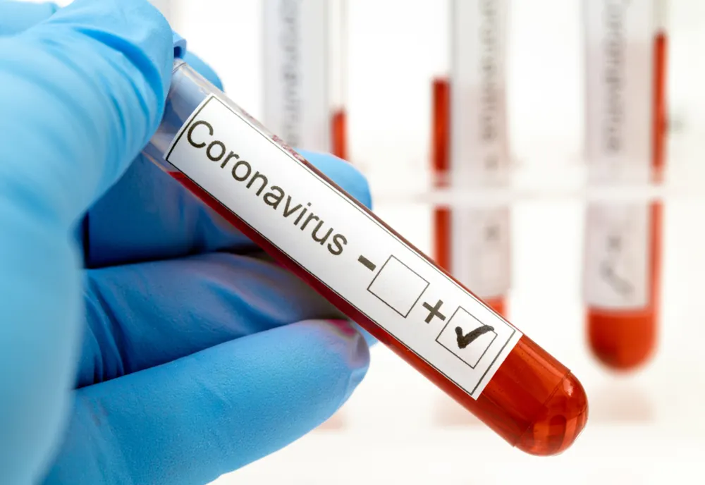 155 de doljeni infecatți cu coronavirus, vindecați