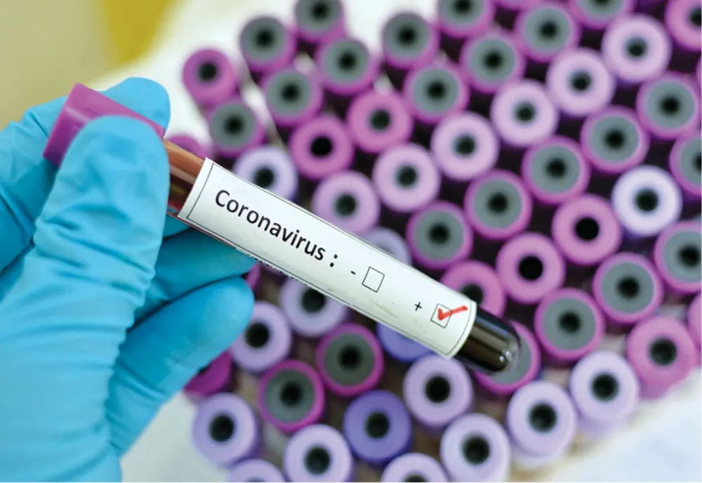 Dolj: Zeci de cazuri noi de coronavirus, înregistrate în ultimele 24 de ore