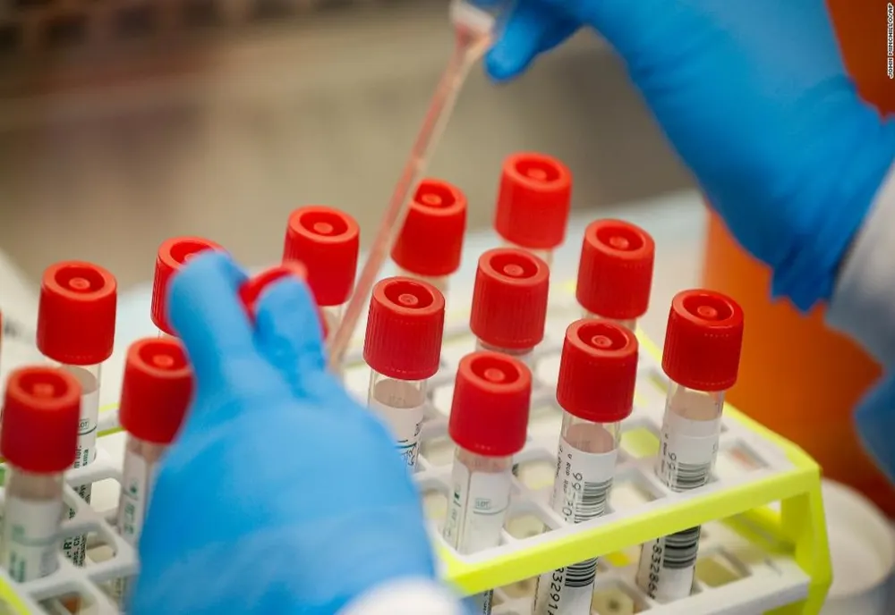 Dolj: 53 de cazuri noi de coronavirus. La cât a ajuns bilanţul