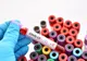13 cazuri noi de coronavirus, în judeţul Dolj