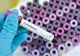 Dolj: Zeci de cazuri noi de coronavirus, înregistrate în ultimele 24 de ore