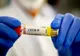Coronavirus CIFRE OFICIALE: Ce se întâmplă în judeţul Dolj