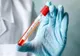 Peste 1.100 cazuri noi de coronavirus, în ultimele 24 de ore, în Dolj